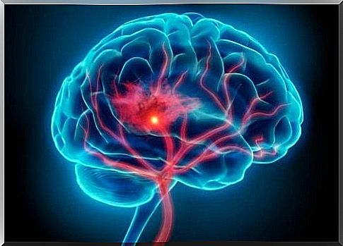 Brain in colors that illustrate the effect of stress